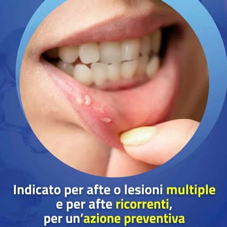 Aftamed Colluttorio Anti Afte Forte Azione Protettiva 150 ml