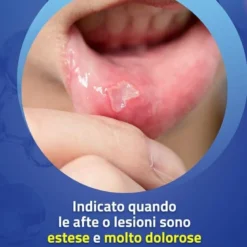 Aftamed Forte Gel Orale Anti Afte ad Alta Intensità 8 ml
