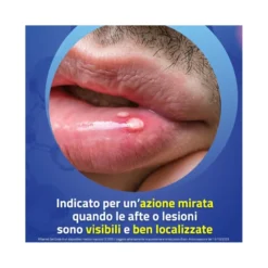 Aftamed gel orale 10ml