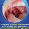 Aftamed Spray Anti Afte Forte Azione Protettiva 20 ml