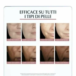 Eucerin Anti-Pigment Correttore Anti-Macchie Viso 15 ml