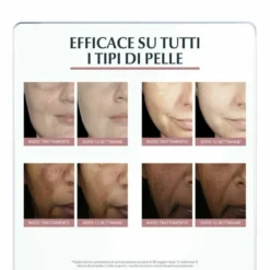 Eucerin Anti-Pigment Dual Serum