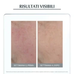 Eucerin Anti-Rose Trattamento Giorno Neutralizzante SPF25 50 ml