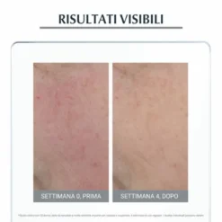 Eucerin Ant-Rose Trattamento Lenitivo Notte 50 ml