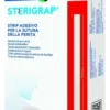 Master-aid sterigrap strip adesivo sutura ferite 100x6 mm 10 pezzi